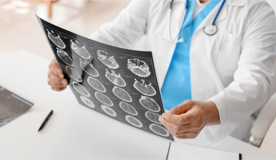 Top Common Car Accident Injuries & Their Lasting Effects