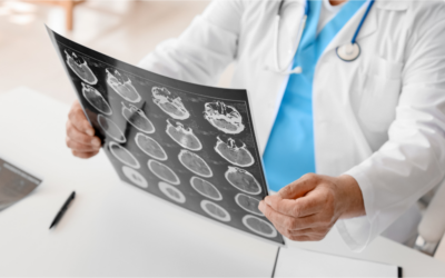 Top Common Car Accident Injuries & Their Lasting Effects